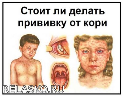 Прививка о кори в советское время