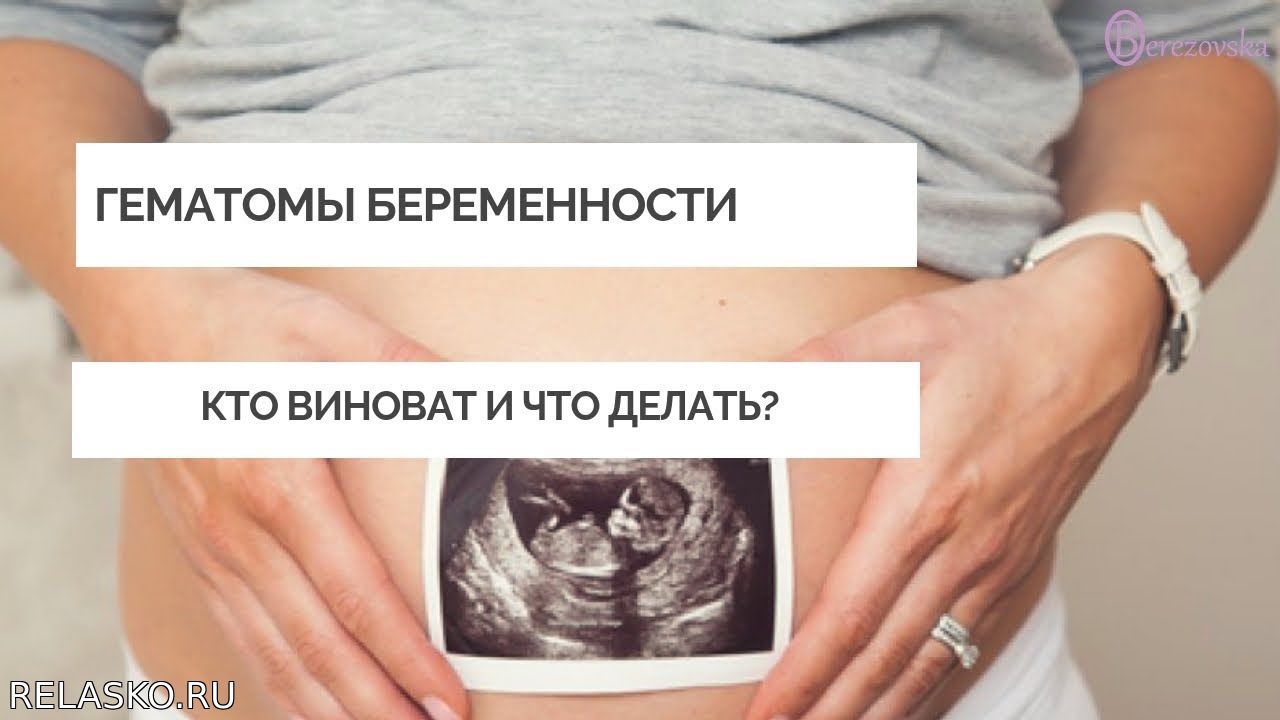 Гематома при беременности 6 недель. Ретрохориальная гематома на УЗИ. Ретрохориальная гематома при беременности на ранних. Гематома на УЗИ при беременности. Папаверин при беременности форум